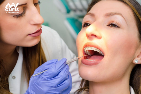 Biện pháp giúp bạn giảm biến chứng rụng răng khi niềng