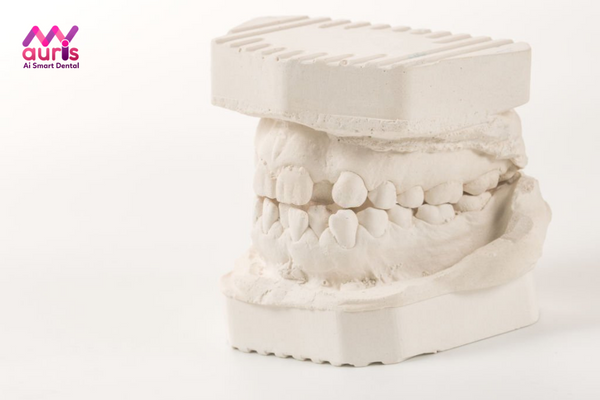 Biểu hiện của tình trạng răng mọc lệch lạc như thế nào?